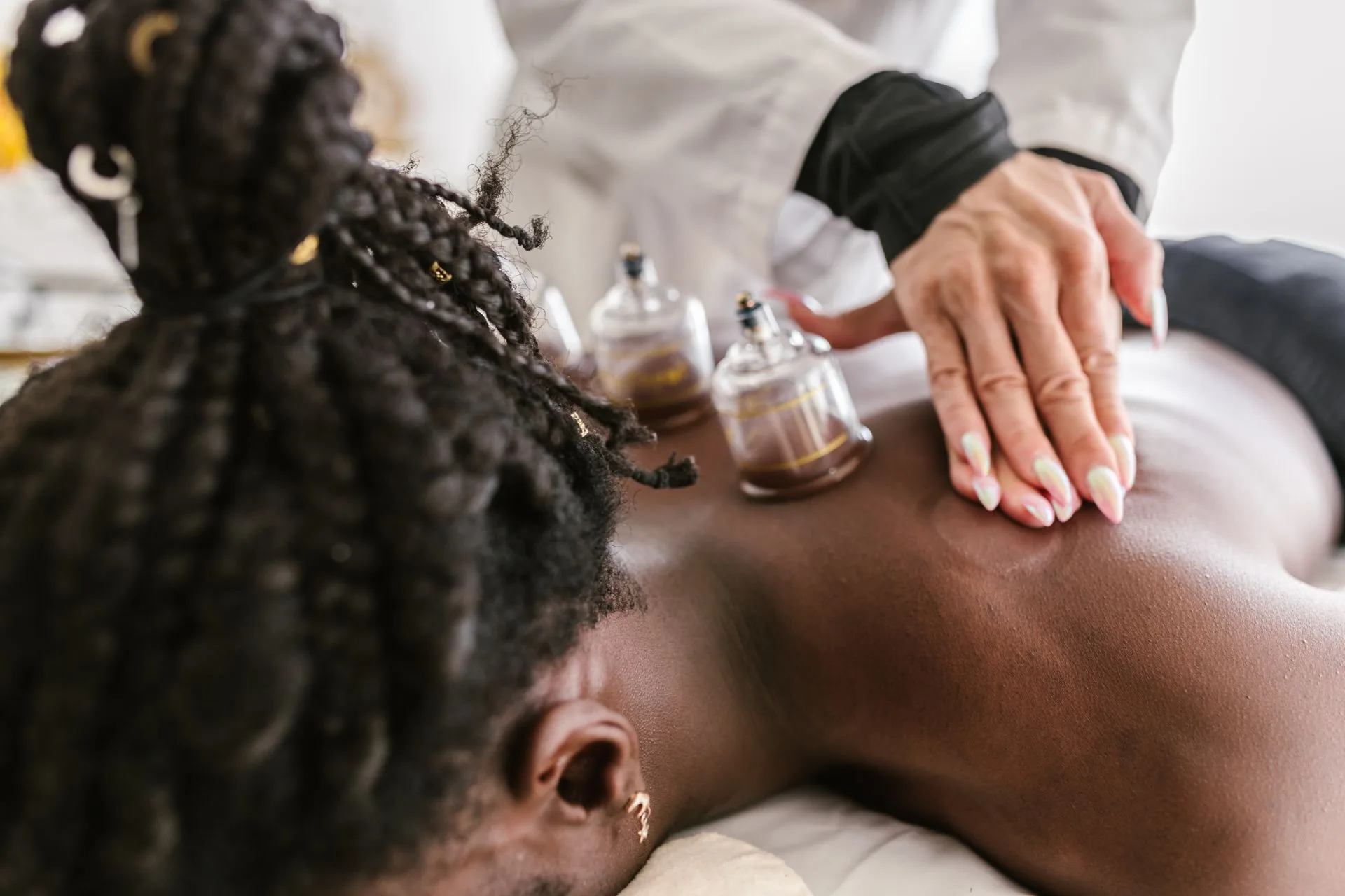 A warm cupping treatment in progress, glass cups on a client's back beside natural oils